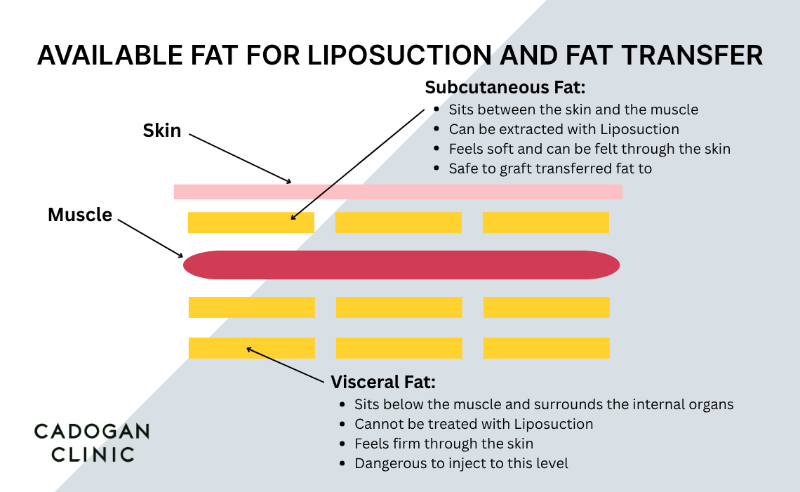 Infograhpic showing the differences between fat found above the muscle and below the muscle